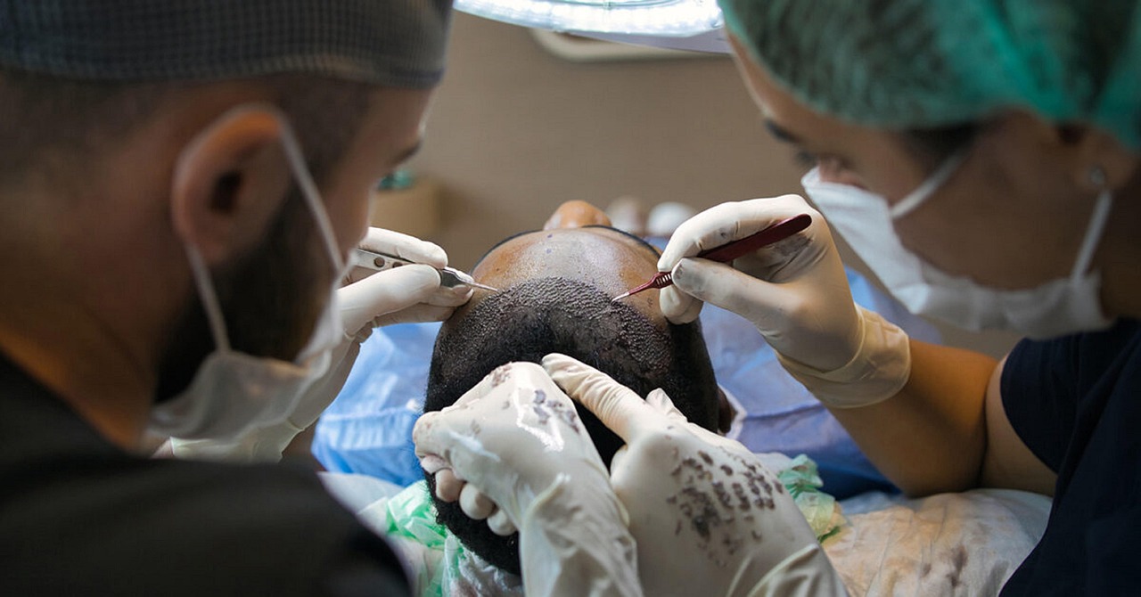 hair transplant for aussies